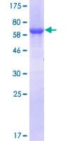 Human GALT Protein (Recombinant GST)