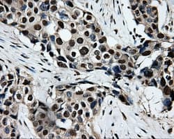 SORD / Sorbitol Dehydrogenase Antibody (clone OTI15H2)