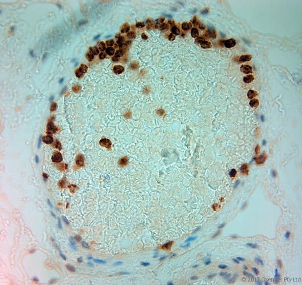 MPO / Myeloperoxidase Antibody