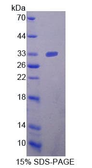 Human NRP2 / Neuropilin 2 Protein (Recombinant His-T7)