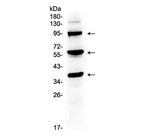 THPO / TPO / Thrombopoietin Antibody
