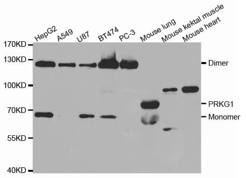 IHC-plus™ PKG / PRKG1 Antibody