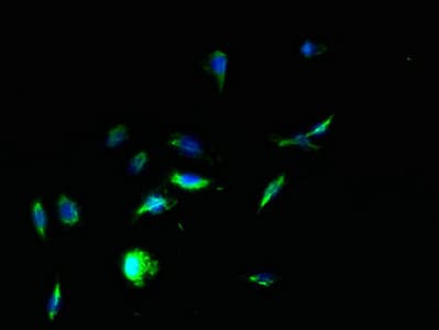 Polyclonal Rabbit anti-Human TPTE Antibody (aa175-380, WB)