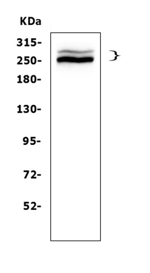 DSP / Desmoplakin Antibody
