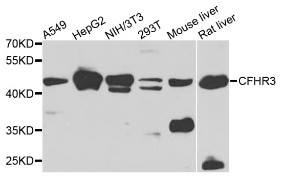 IHC-plus™ CFHR3 / CFHL3 Antibody
