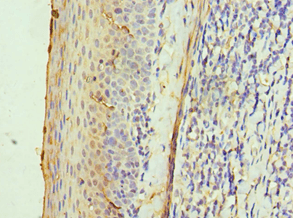 Polyclonal Rabbit anti-Human ALAS2 Antibody (aa50-320, IHC, WB)