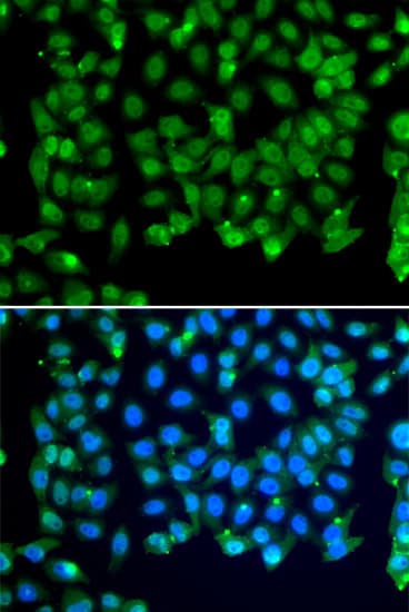 Polyclonal Rabbit anti-Human RNF8 Antibody (IHC, IF, WB)