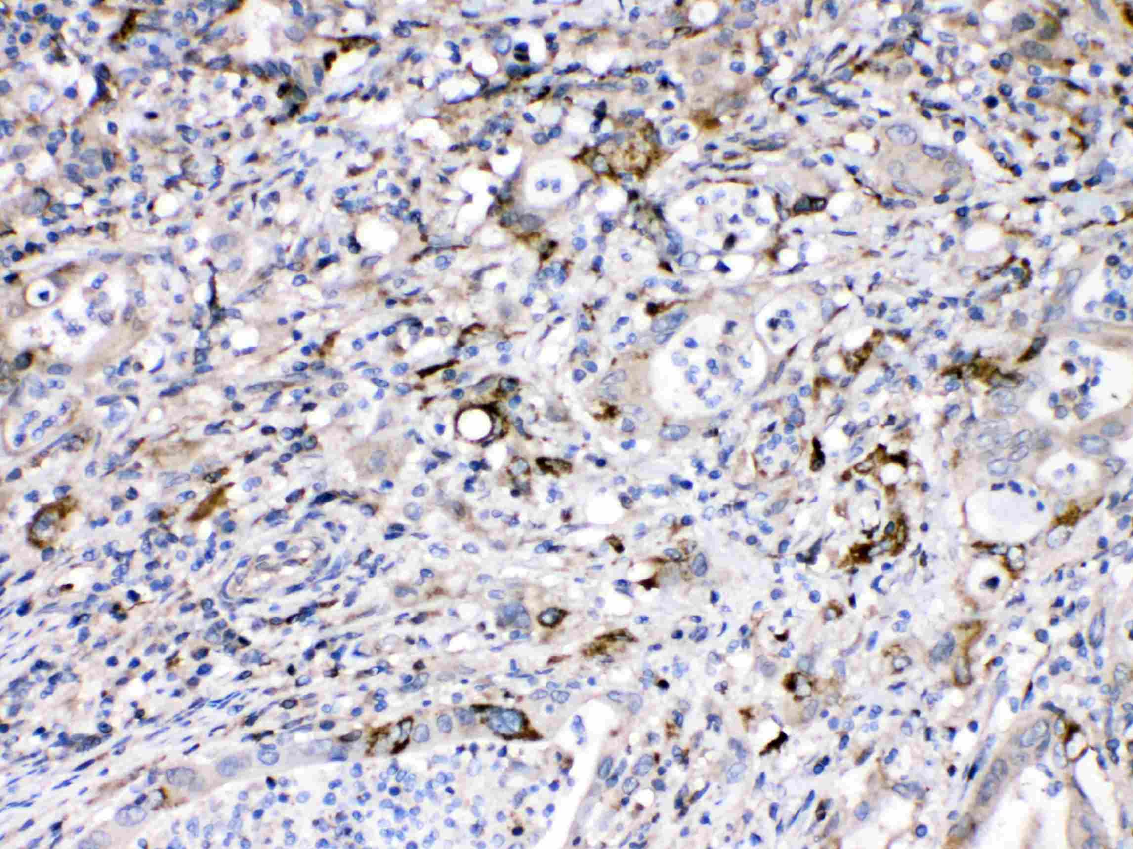 BAX Antibody