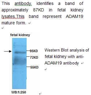IHC-plus™ Polyclonal Rabbit anti-Human ADAM19 Antibody (IHC, WB)