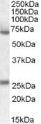 IHC-plus™ SERPINF2 / Alpha-2-Antiplasmin Antibody (aa454-468)