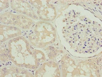 Polyclonal Rabbit anti-Human SPACA1 Antibody (IHC)