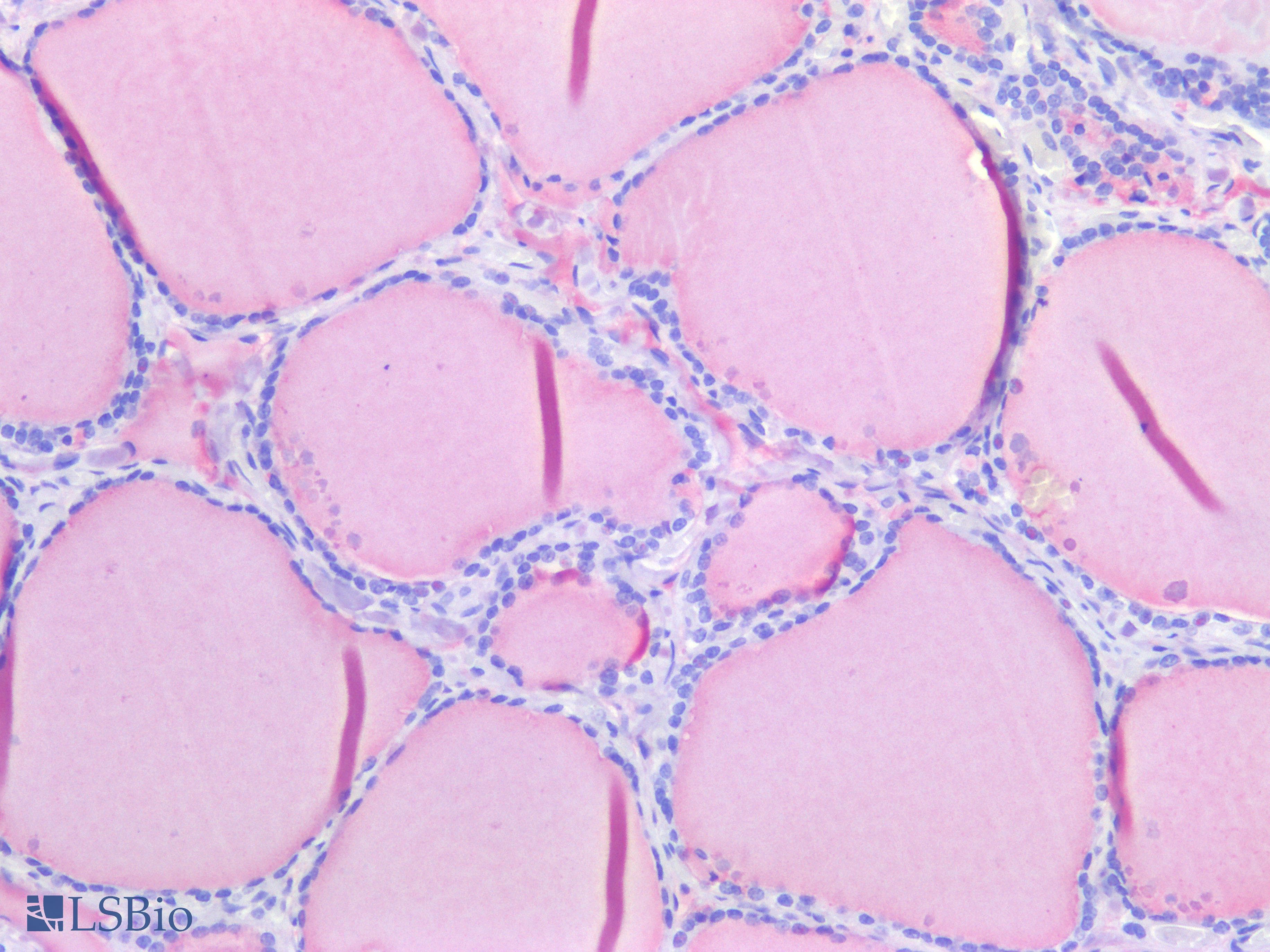 PathPlus™ TG / Thyroglobulin Antibody