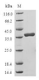 Human LELP1 Protein (Recombinant GST, N-terminus)