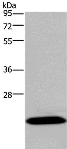 Polyclonal Rabbit anti-Human KCNMB4 Antibody (IHC, WB)