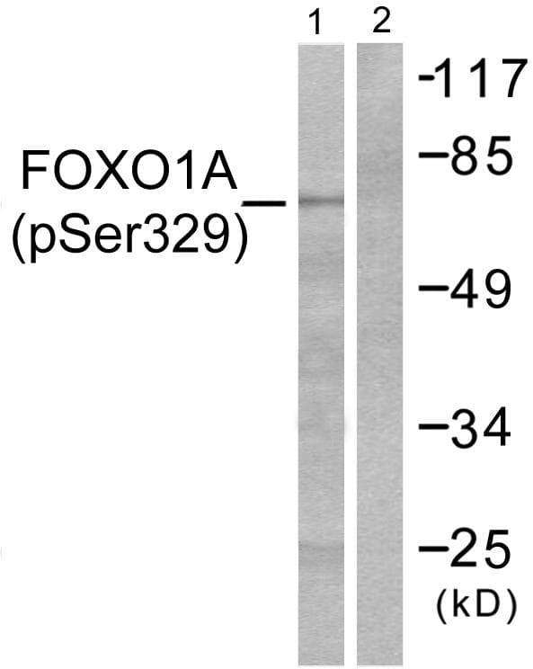 FOXO1 / FKHR Antibody (phospho-Ser329)