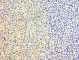 TRAIL-R4 / DCR2 Antibody (aa257-386)