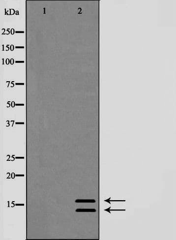 Polyclonal Rabbit anti-Human MAP1LC3B / LC3B Antibody (IHC, IF, WB)