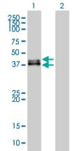 IHC-plus™ DUSP6 / MKP3 Antibody (clone 3G2)