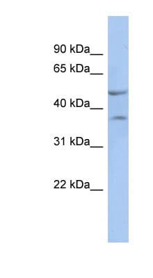 NKX6-1 Antibody (N-Terminus)