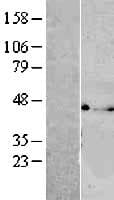 VTA1 Protein (Over-Expression Lysate Myc-DDK (Flag))
