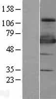 ZSCAN18 / ZNF447 Protein (Over-Expression Lysate Myc-DDK (Flag))