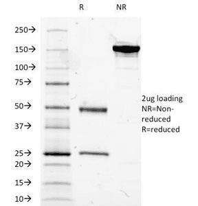 MUC5AC Antibody (clone 2-11M1)