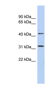 METTL6 Antibody (aa35-84)