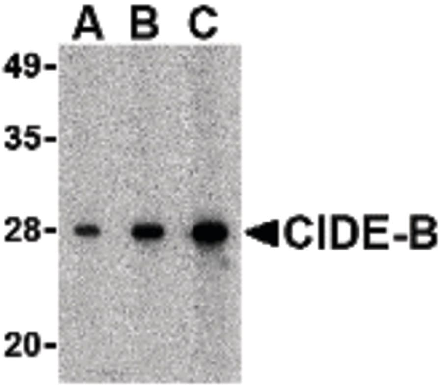 IHC-plus™ CIDEB Antibody