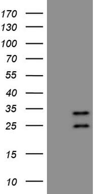 Monoclonal Mouse anti-Human AKIP1 / BCA3 Antibody (clone OTI1E3, WB)