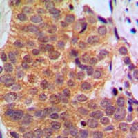 RARB / RAR Beta Antibody (C-Terminus)