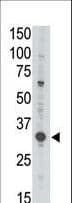 MAGEA3 Antibody (aa283-314)