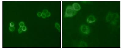 TYRO3 Antibody (clone 6D6F10)
