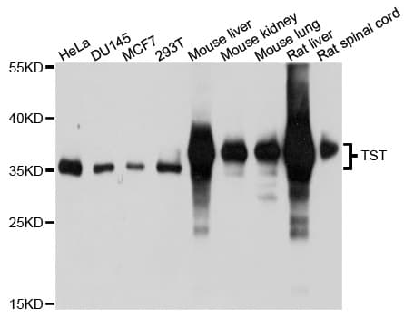 Polyclonal Rabbit anti-Human Rhodanese / TST Antibody (WB)