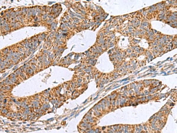 NFS1 Antibody