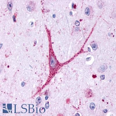 PathPlus™ GPR48 / LGR4 Antibody (N-Terminus)