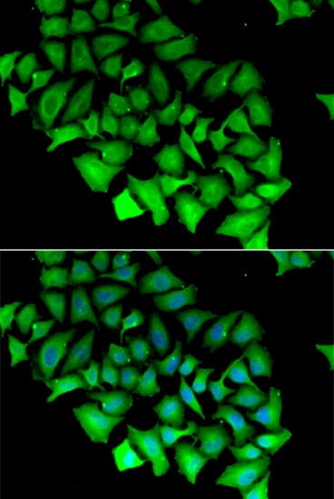 ACY1 / Aminoacylase 1 Antibody