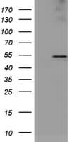LPL / Lipoprotein Lipase Antibody (clone OTI6B4)