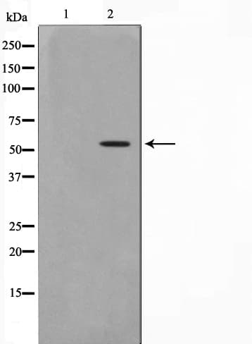 DUS2 / DUS2L Antibody