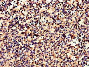 CNR2 / CB2 Antibody