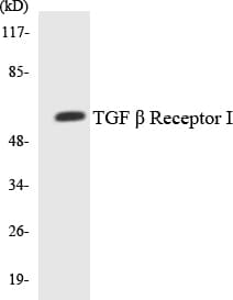 TGFBR1 / ALK5 Antibody (aa112-161)