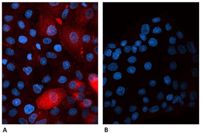B2M / Beta 2 Microglobulin Antibody (clone B2M-01, AF647)