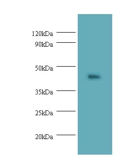 NAPSA / NAPA / Napsin A Antibody