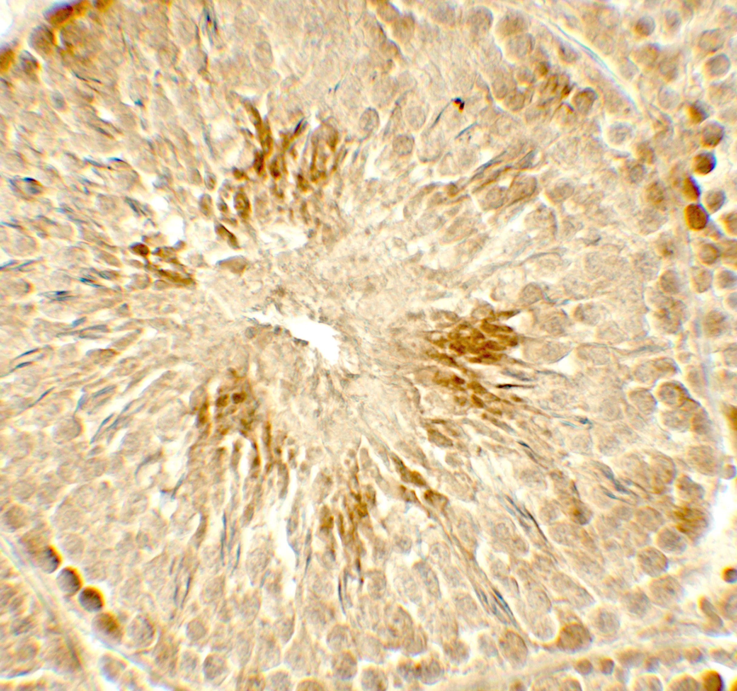 Polyclonal Rabbit anti-Human HDAC2 Antibody (IHC, IF, WB)