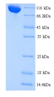 Mouse CTCFL / BORIS Protein (Recombinant His)
