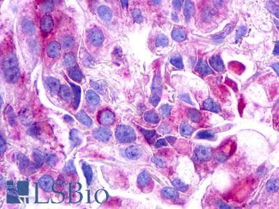 PathPlus™ GALR3 / Galanin Receptor 3 Antibody (Cytoplasmic Domain)