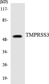 TMPRSS3 Antibody (aa391-440)