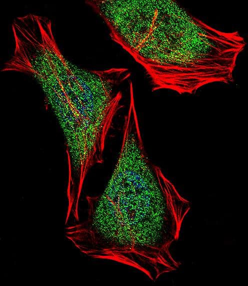 Polyclonal Rabbit anti-Human ECSIT Antibody (aa396-425, IF, WB)