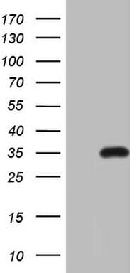 TNFSF5IP1 / CLAST3 Antibody (clone OTI1A1)