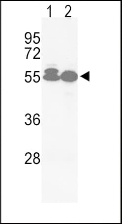 ACVRL1 Antibody (aa474-503)