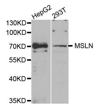 Polyclonal Rabbit anti-Human MSLN / Mesothelin Antibody (IHC, IF, WB)